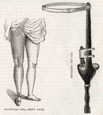 Artificial leg (left), above knee and (right) kneeling pin leg produced by Ellis, Son and Paramore, wholesale and retail manufacturers of surgical instruments and appliances, No. 3 King Street Works and Spring Street
