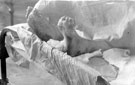Frost bitten feet, Med. Exp. Force, 3rd Northern General Hospital, World War I