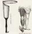 View: y15000 Artificial leg (left), with pin and (right) artificial leg, below knee produced by Ellis, Son and Paramore, wholesale and retail manufacturers of surgical instruments and appliances, No. 3 King Street Works, Spring Street